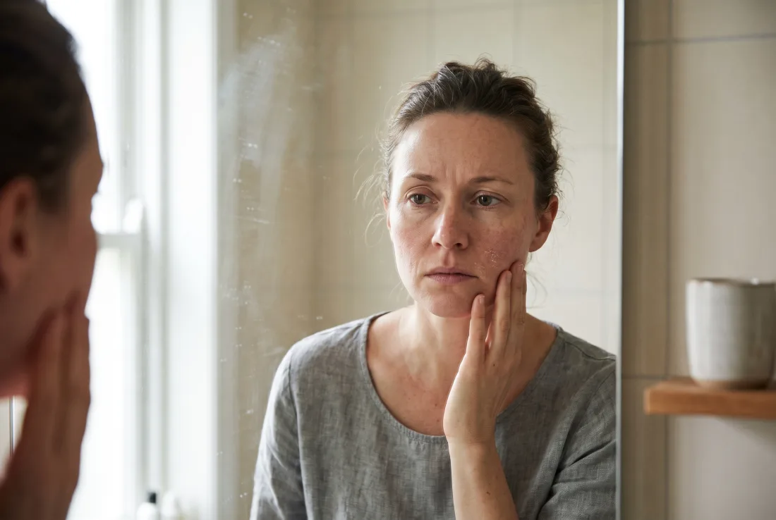 A woman examining her tight, reddened skin in the mirror